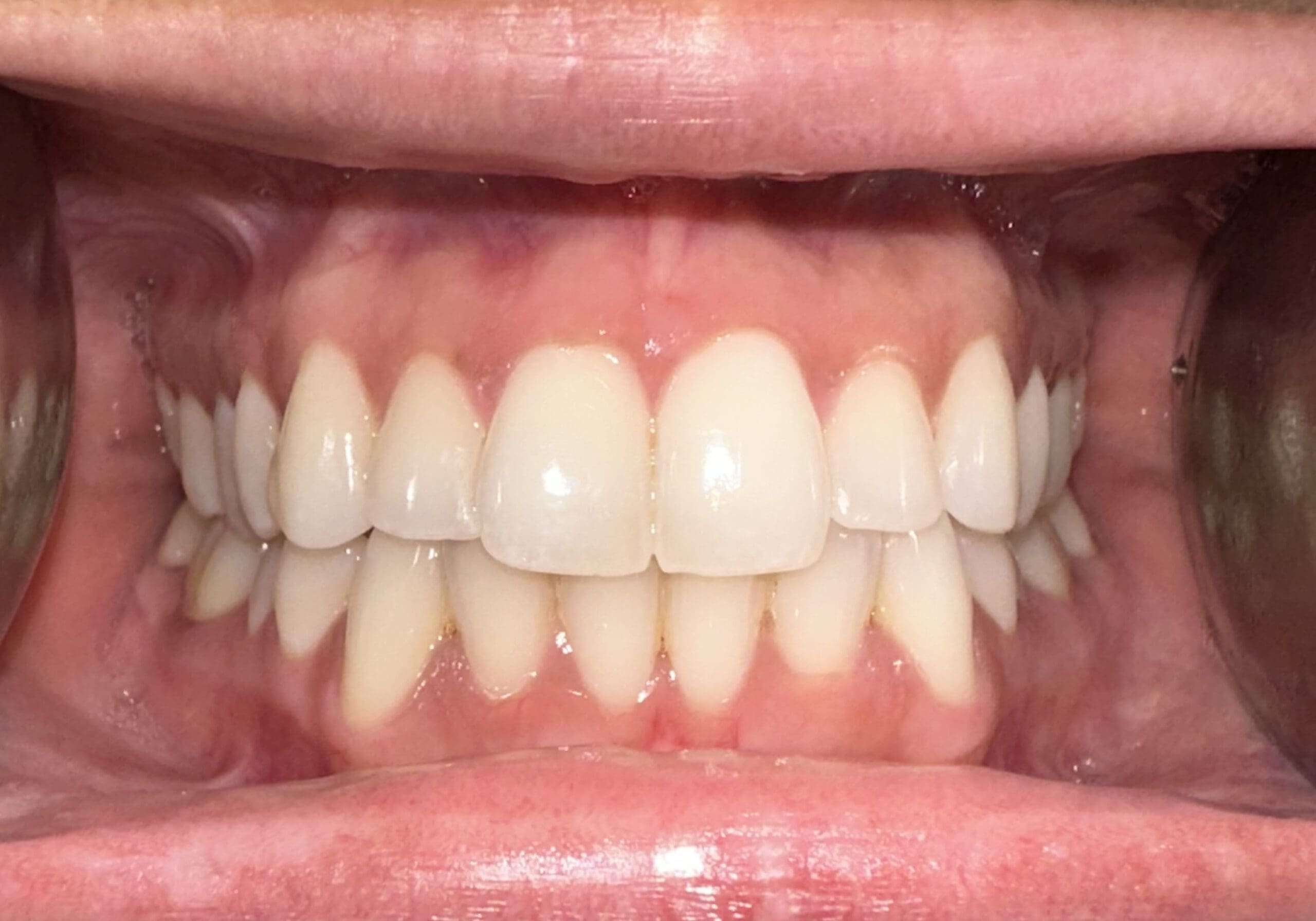 virtual orthodontic consult center