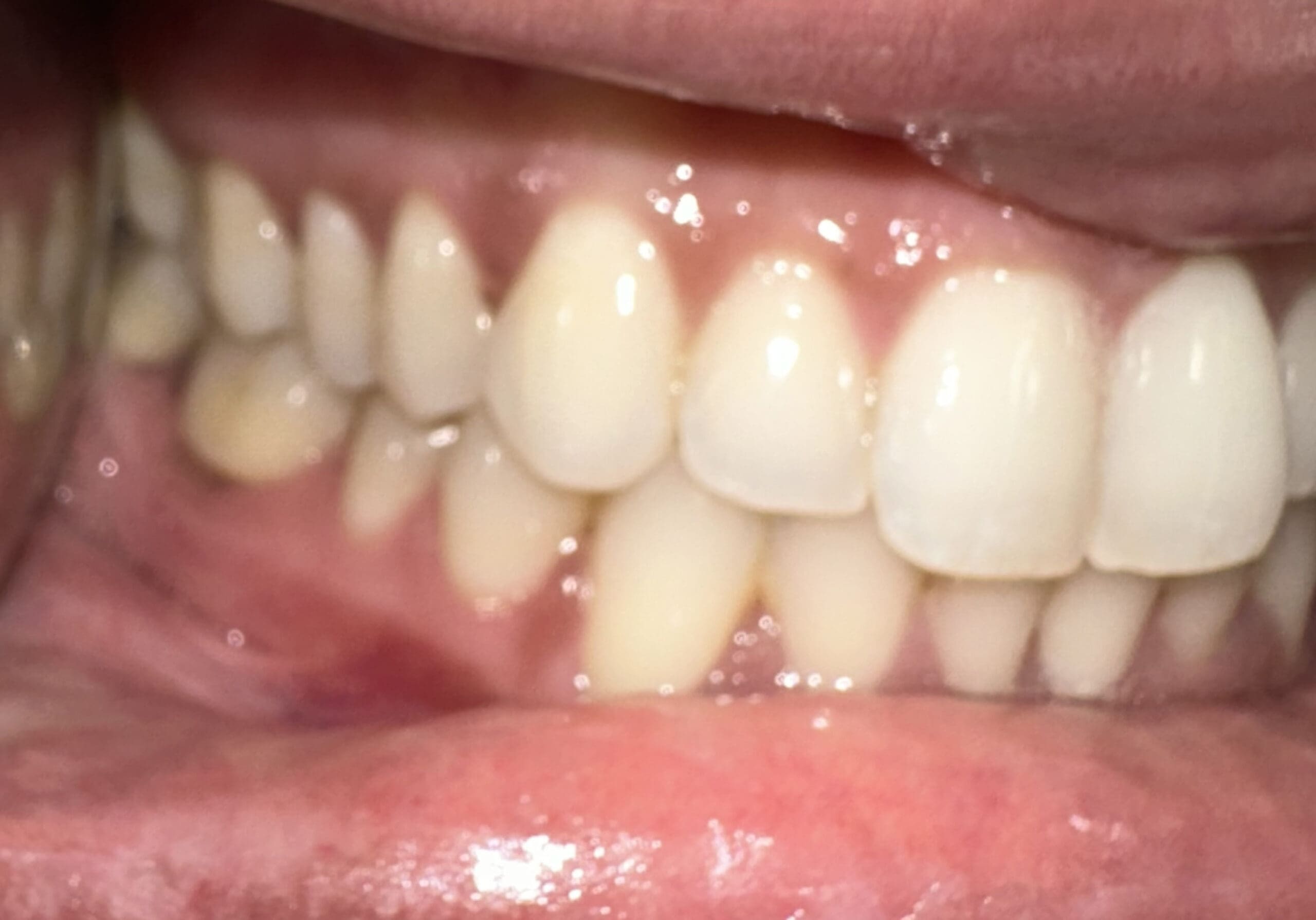 right mouth virtual consult photo